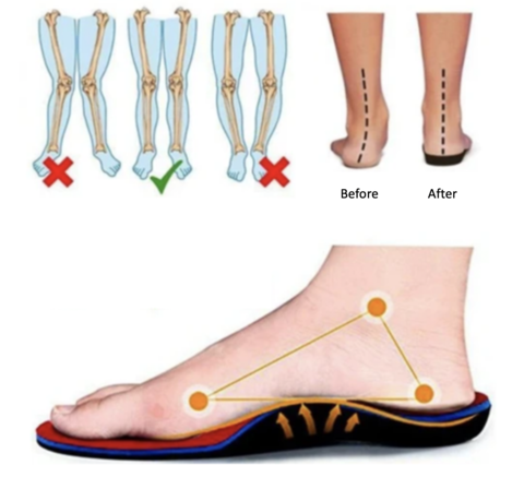 Rosie | Comfortable and Orthopedic Sneakers